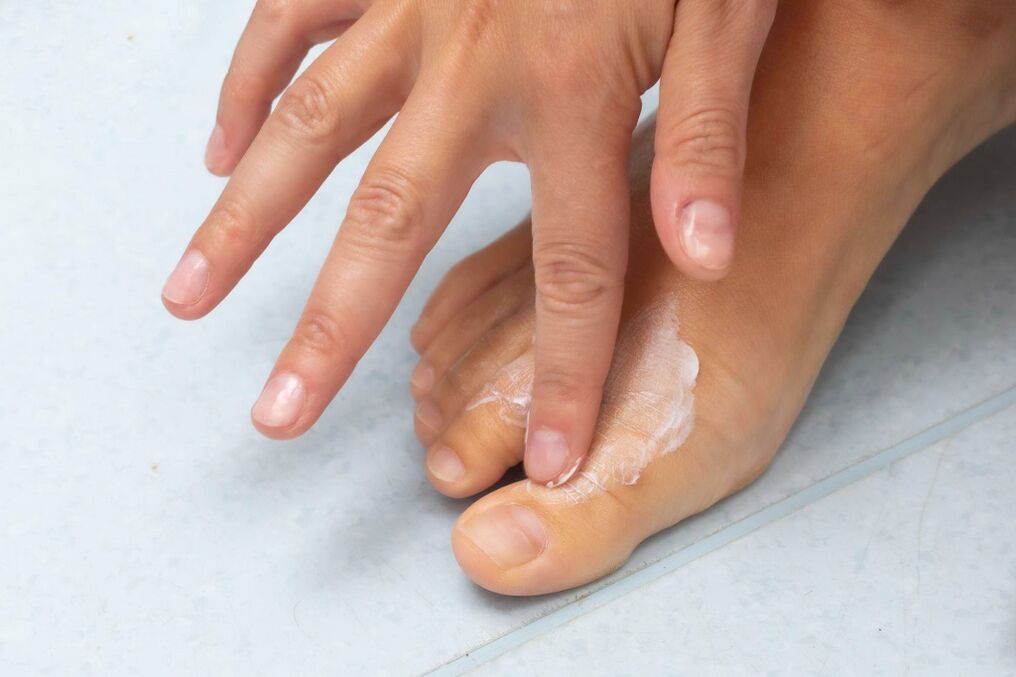 Aplicación da crema Demyxil do fungo entre os dedos dos pés
